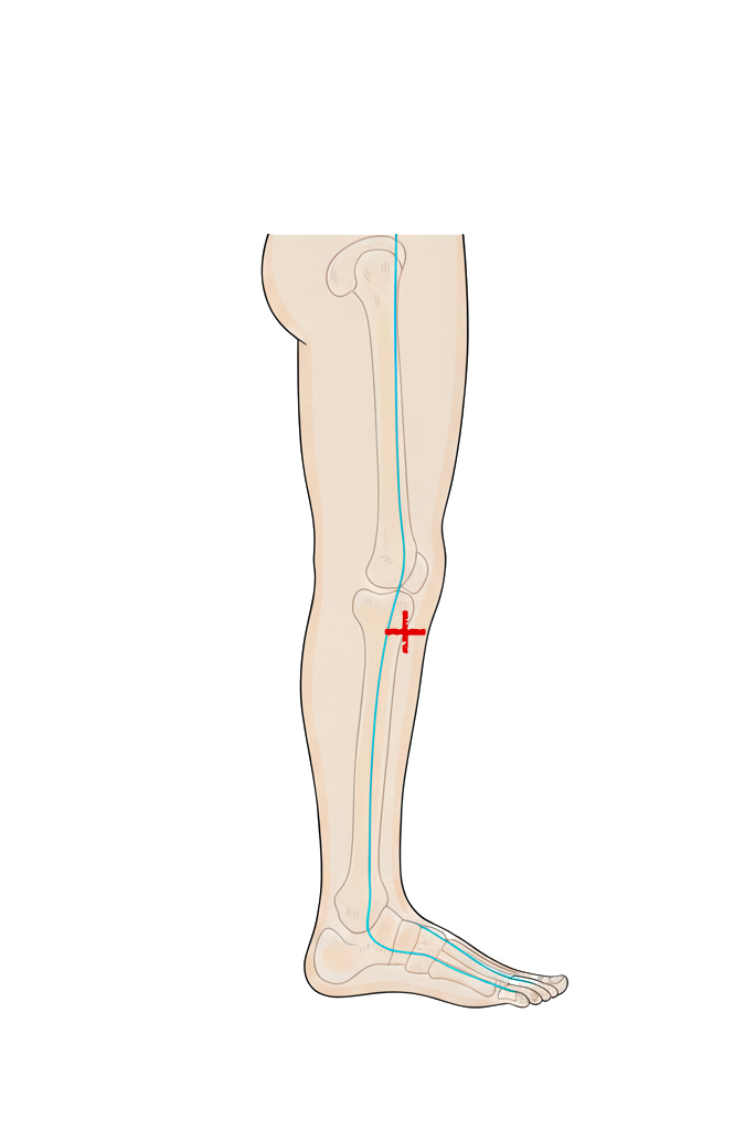 阳陵泉穴 / GB-34 / Yanglingquan / Yang Mound Spring