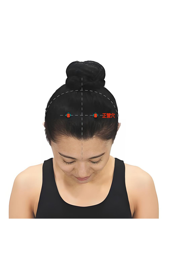 正营穴 / GB-17 / zhengying / Proper Nourishment